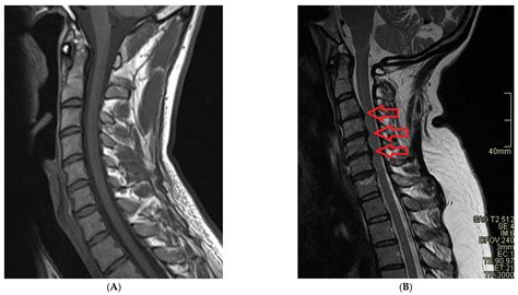cervical spine mri results interpretation|The Art of Interpreting Cervical Spine Radiographs.